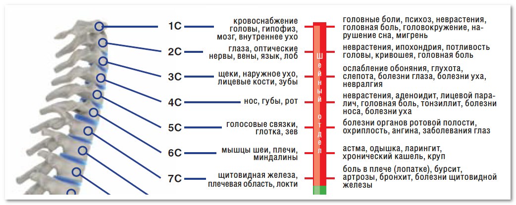 Схема лечения шейного остеохондроза форум