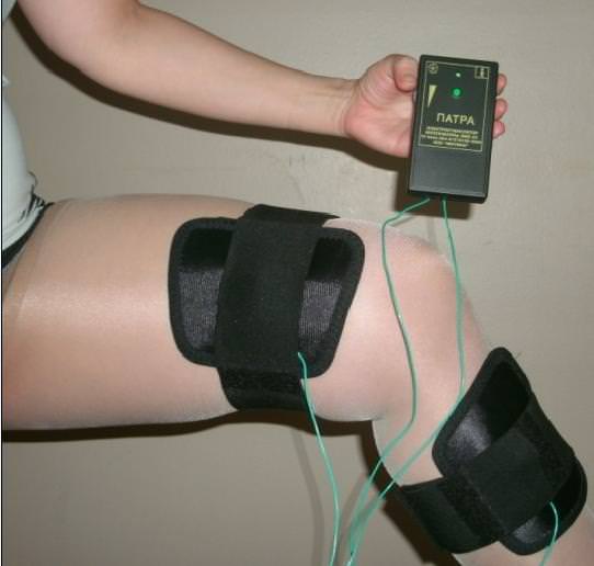 электромиостимуляция - физиотерапия суставов 