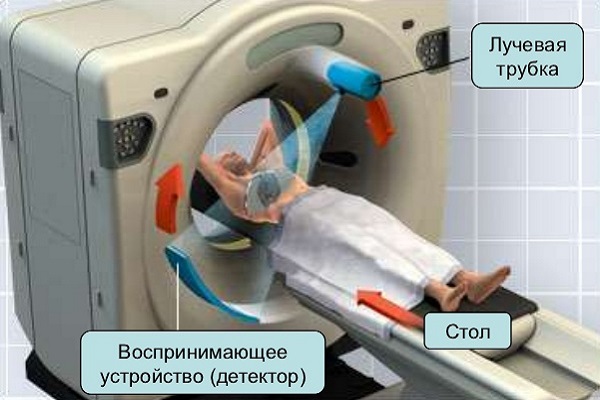 рентгеновская компьютерная томография