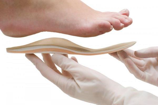 5 правил выбора ортопедических стелек при плоскостопии