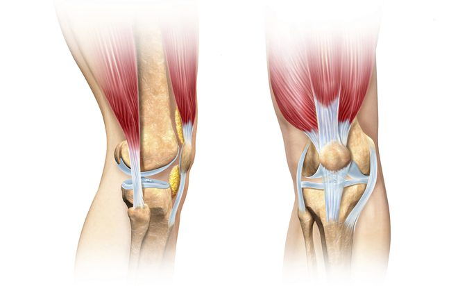 Как определить разрыв связок коленного сустава и что с этим делать